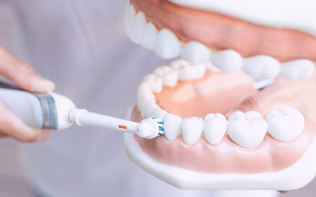 Saiba como controlar a Placa Bacteriana em Próteses e Coroas sobre Implantes