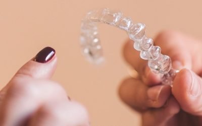 Alinhe os seus dentes em segredo