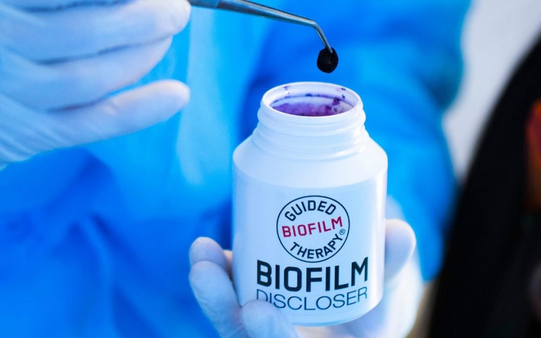 Sabia que existe um corante que deteta placa bacteriana na hora?