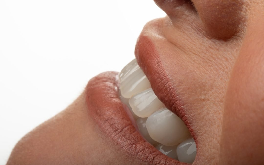 Cuidados de Higiene Oral em Implantes Dentários
